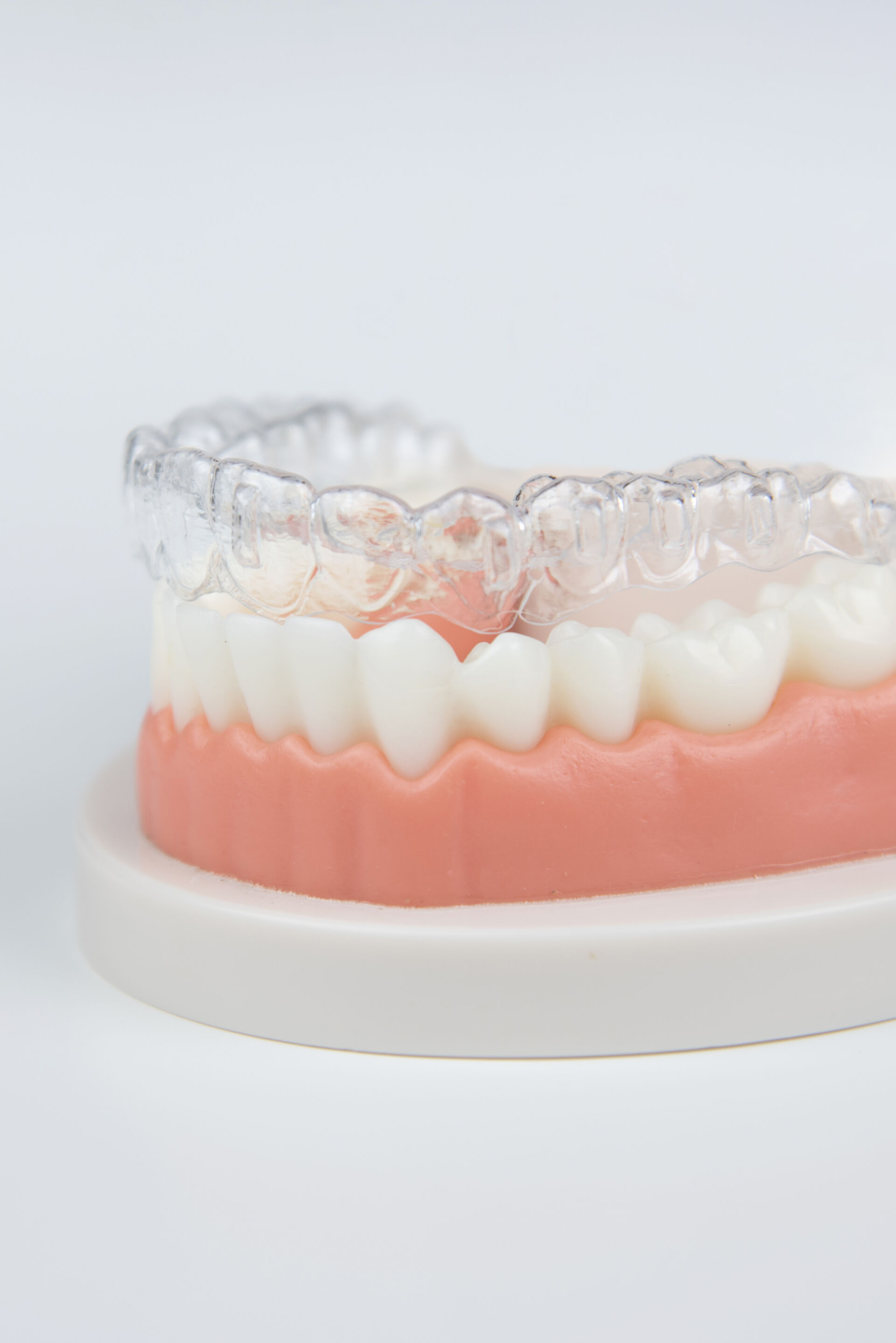 Invisible and removable aligners for teeth alignment